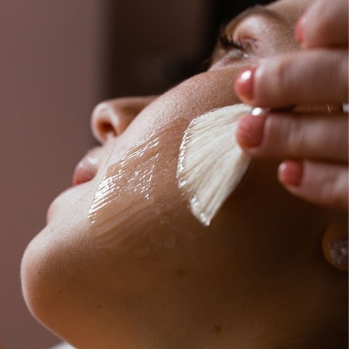 Chemical Peel